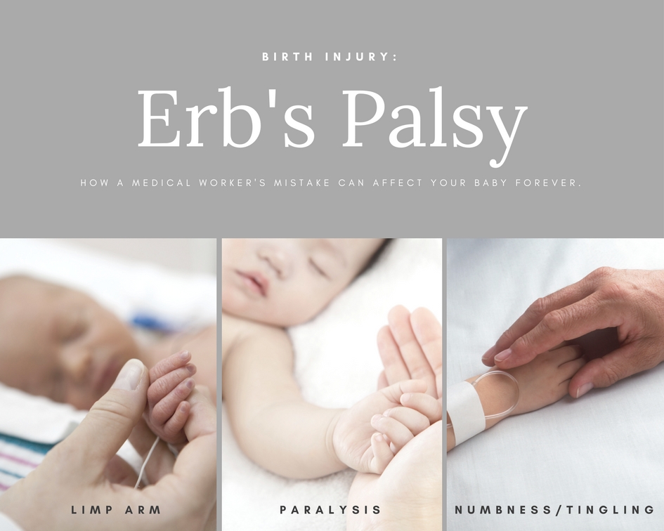 Birth Injury | Erb's Palsy Attorneys